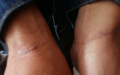 ONU lembra direito à verdade para vítimas de violações de direitos humanos