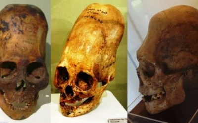 Eles praticavam deformação do crânio